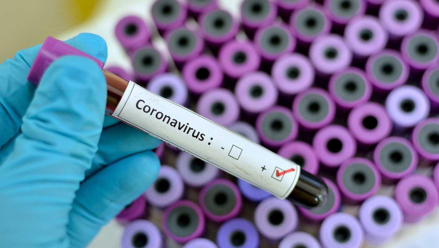 Para la OMS el mundo deberiacutea prepararse para una ldquopotencial pandemiardquo del coronavirus