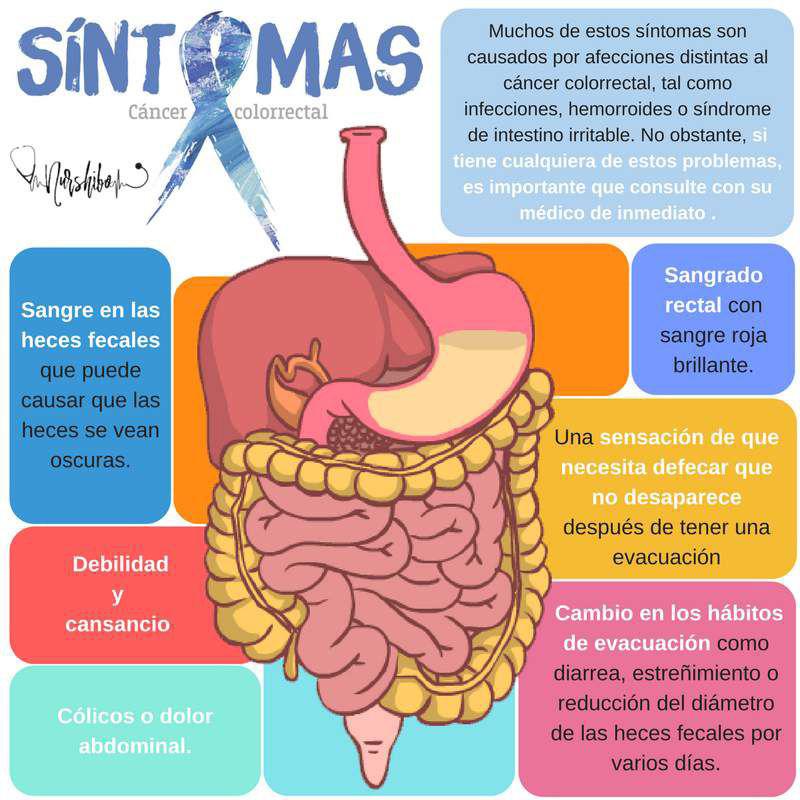 Caacutencer de colon- aconsejan bajar a 45 la edad para iniciar con los estudios preventivos