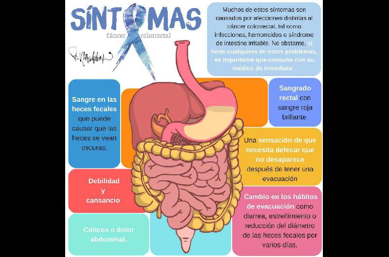 Caacutencer de colon- aconsejan bajar a 45 la edad para iniciar con los estudios preventivos