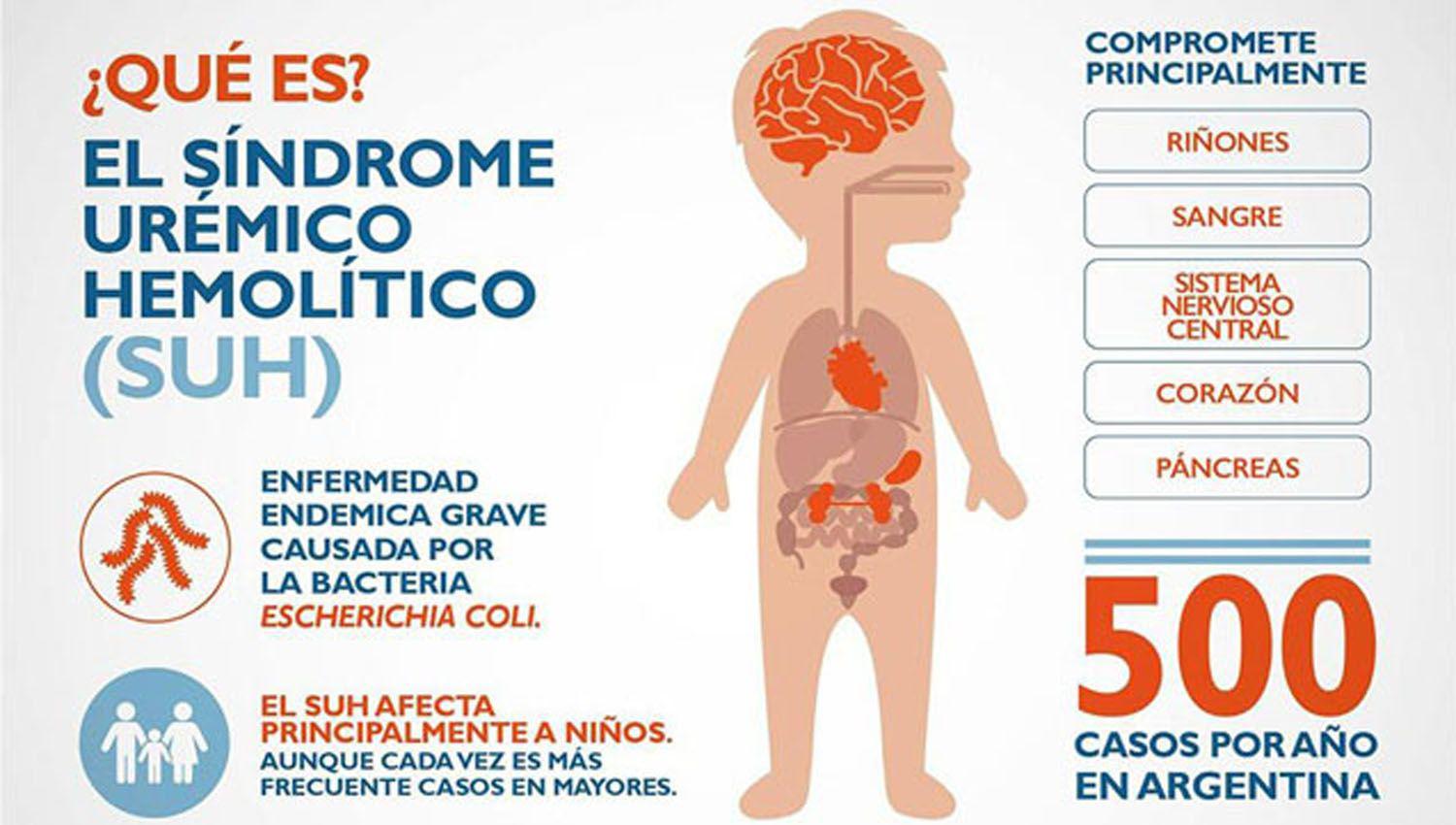 Piden tomar recaudos para prevenir casos de siacutendrome ureacutemico hemoliacutetico en nintildeos