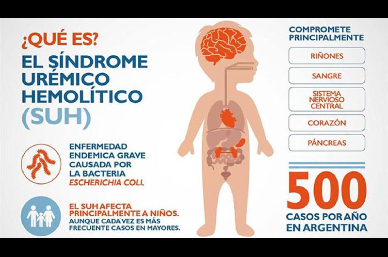 Piden tomar recaudos para prevenir casos de siacutendrome ureacutemico hemoliacutetico en nintildeos