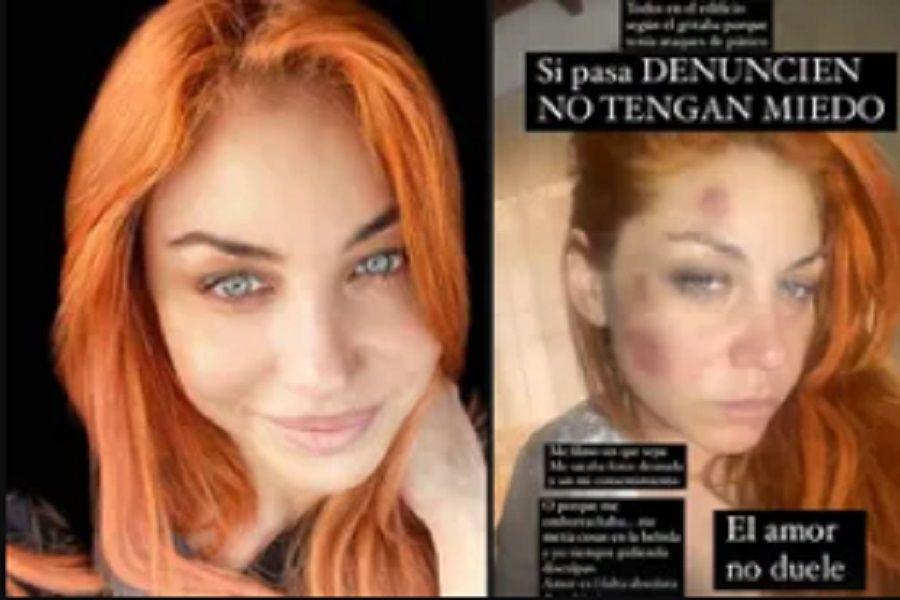 Lourdes de Bandana lanzoacute una brutal denuncia contra su ex y mostroacute su rostro lleno de moretones