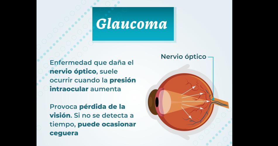 Presioacuten ocular- todo lo que debes saber para evitar el glaucoma a partir de los 40