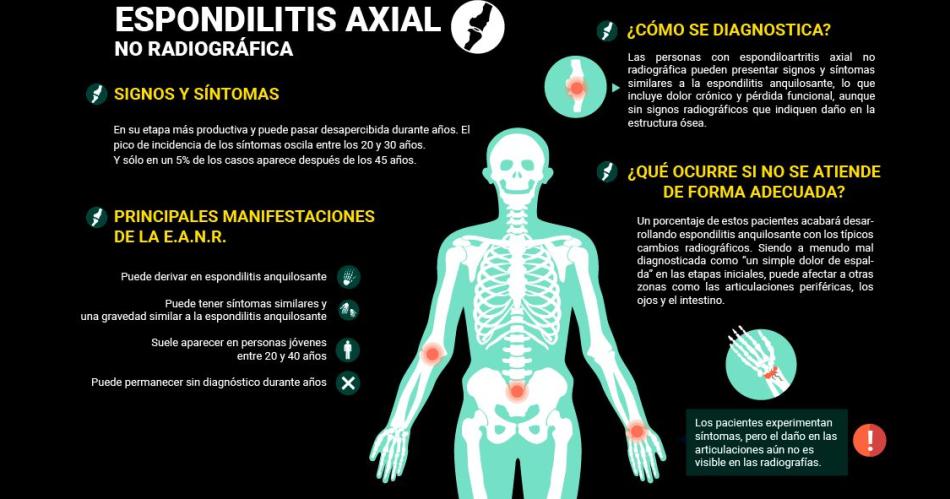 Una enfermedad reumatoloacutegica ocultar detraacutes del dolor de espaldas