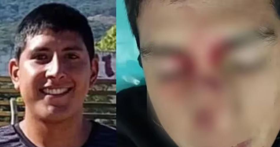 Agredieron brutalmente a un aacuterbitro en pleno partido y le desfiguraron la cara