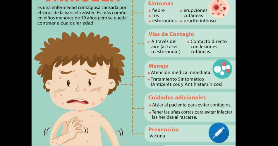 Crecen los casos de varicela en la poblacioacuten infantil- coacutemo actuar ante los primeros siacutentomas