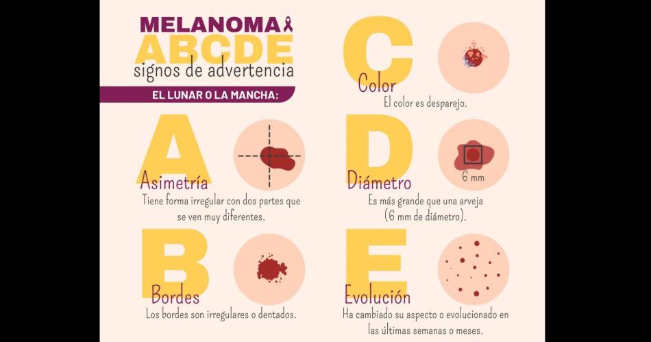 Alerta por el aumento de casos de caacutencer de piel en pacientes de alrededor de 40 antildeos