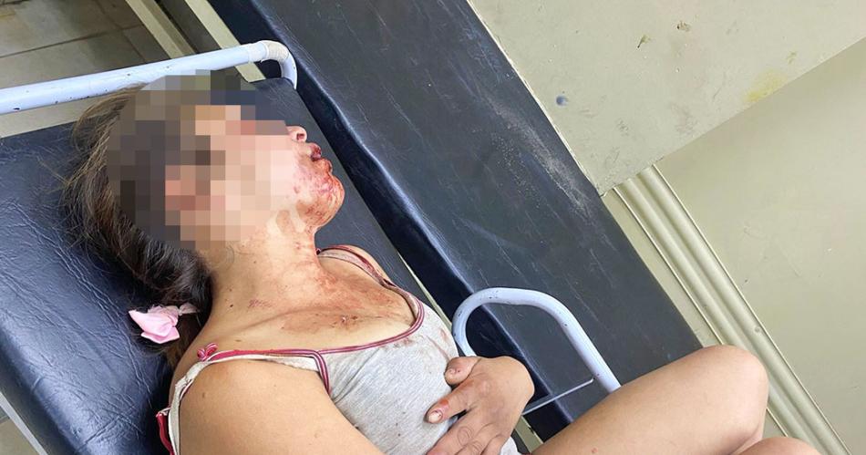 Brutal- su novio le fracturoacute la mandiacutebula a golpes ingresoacute al Regional pero quedoacute detenida