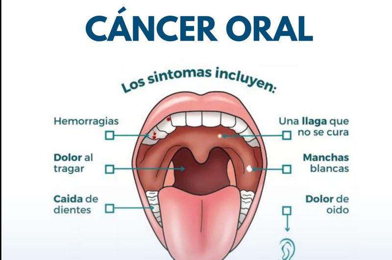 Alertan que el consumo de tabaco y alcohol potencia las chances de sufrir caacutencer bucal