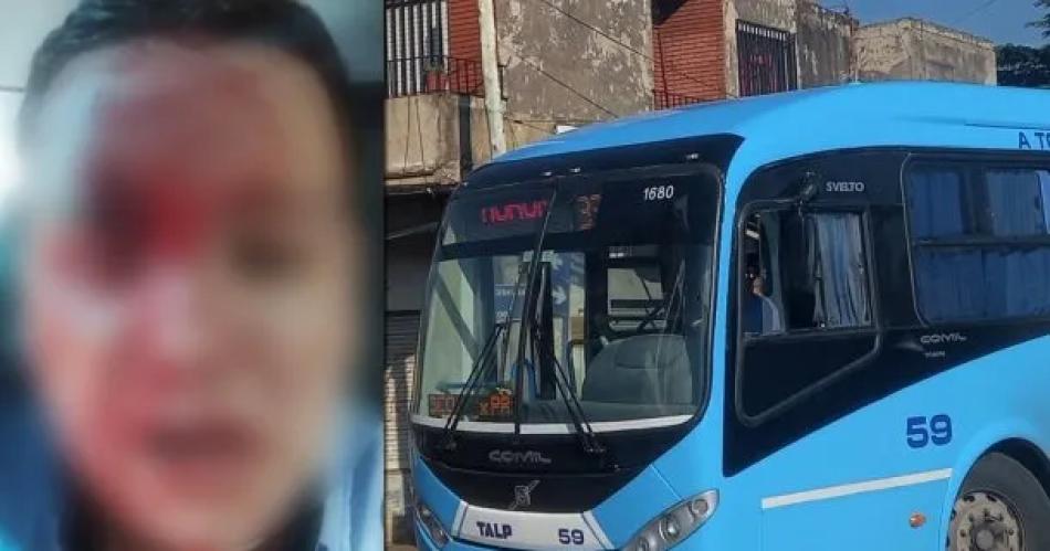 Brutal ataque- un pasajero le partioacute una botella en la cabeza al chofer de colectivo